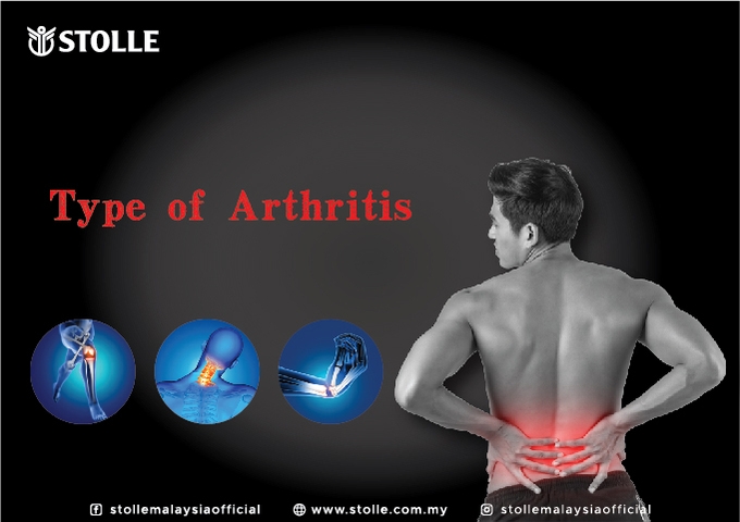 Let's differentiate the type of Arthritis