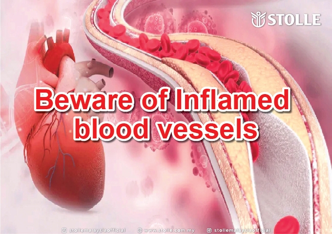 Beware of Inflamed Blood Vessels