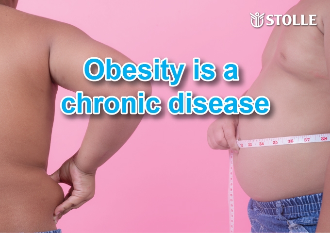 Obesity is a chronic disease