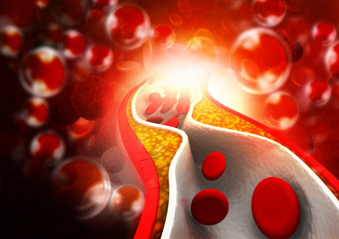 How is cholesterol moved around the body?